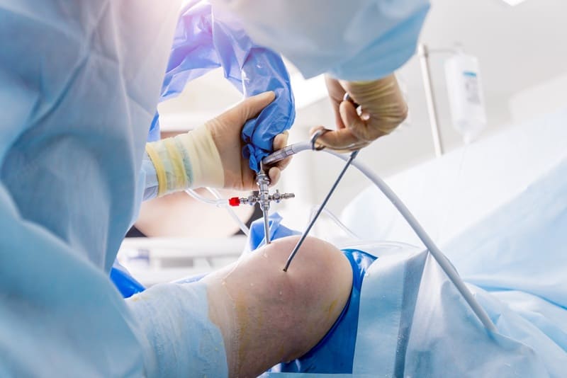 Artroscopia de rodilla en Lindavista, Juárez, CDMX